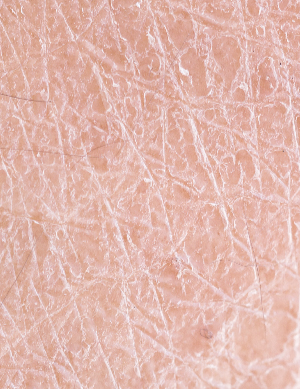 乾燥肌をや小じわが気になる