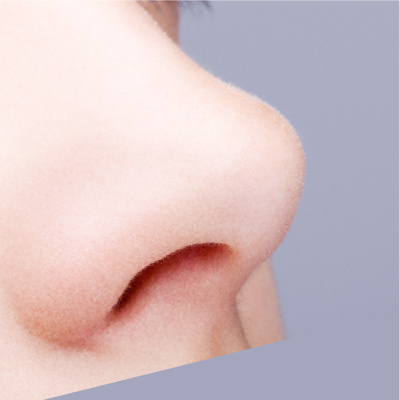 くすみや毛穴汚れ美肌のお悩み